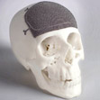 3d printed part of a skull bone