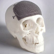 3d printed part of a skull bone 3d printed part of a skull bone